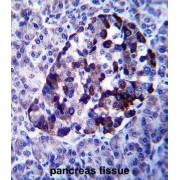 Probable E3 Ubiquitin-Protein Ligase MID2 (MID2) Antibody