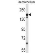 Autophagy-Related Protein 2 Homolog A (ATG2A) Antibody