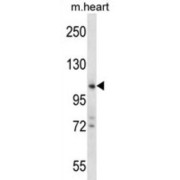 Zinc Finger CCHC Domain-Containing Protein 14 (ZCCHC14) Antibody