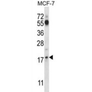 Sjogren Syndrome/Scleroderma Autoantigen 1 (SSSCA1) Antibody