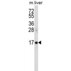Sjogren Syndrome/Scleroderma Autoantigen 1 (SSSCA1) Antibody