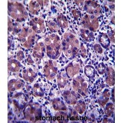 abx027523