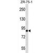 WB analysis of ZR-75-1 cell line lysates.