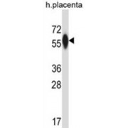 Prolyl-4-Hydroxylase Alpha Polypeptide III (P4HA3) Antibody