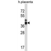 Intelectin 2 (ITLN2) Antibody