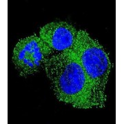 Amyloid-beta Precursor Protein (APP) Antibody