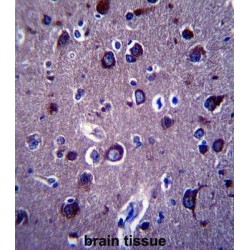 Amyloid-beta Precursor Protein (APP) Antibody