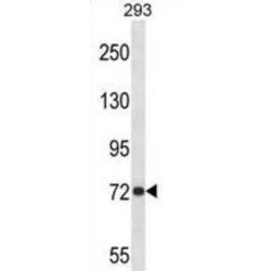 Amyloid-beta Precursor Protein (APP) Antibody