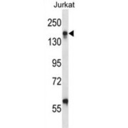 Integrin Alpha-L (ITGAL) Antibody