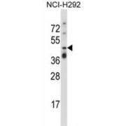 Tumor Necrosis Factor Receptor Superfamily Member 10A / CD261 (TNFRSF10A) Antibody