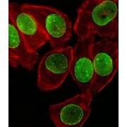 Small Ubiquitin Related Modifier Protein 1 (SUMO1) Antibody