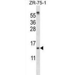 Small Ubiquitin Related Modifier Protein 1 (SUMO1) Antibody