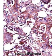 Lectin-Galactoside Binding Soluble 3 (LGALS3) Antibody