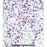 Cytoplasmic Protein NCK1 (NCK1) Antibody