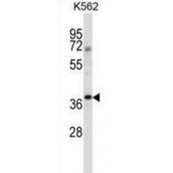 Cytoplasmic Protein NCK1 (NCK1) Antibody