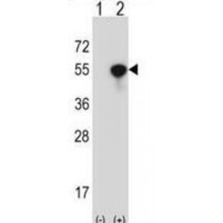 Cytoplasmic Protein NCK1 (NCK1) Antibody