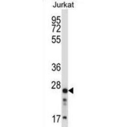 Rho GDP-Dissociation Inhibitor 2 (ARHGDIB) Antibody