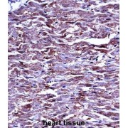 Matrix Metalloproteinase 15 (MMP15) Antibody