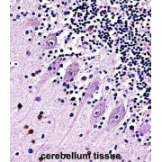 Transient Receptor Potential Cation Channel Subfamily C Member 5 (TRPC5) Antibody