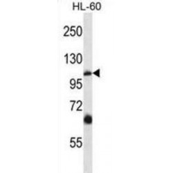 Transient Receptor Potential Cation Channel Subfamily C Member 5 (TRPC5) Antibody