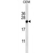 Chromobox Protein Homolog 5 (CBX5) Antibody