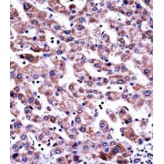 Rab GDP Dissociation Inhibitor Beta (GDI2) Antibody
