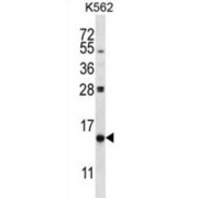Phosphoinositide-3-Kinase Interacting Protein 1 (PIK3IP1) Antibody