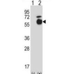 Activin Receptor Type-1 (Acvr1) Antibody
