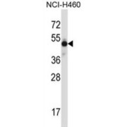 Homeobox Protein Mohawk (MKX) Antibody