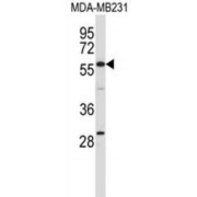 EH Domain Containing 1 (EHD1) Antibody