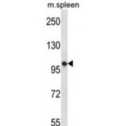 RNA Polymerase III Subunit B (POLR3B) Antibody