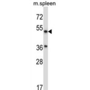 Phospholipase ABHD3 (ABHD3) Antibody