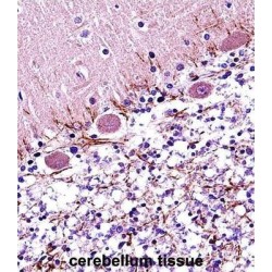 Retinoic Acid Receptor Alpha (RARA) Antibody