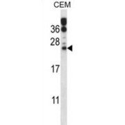 Ras-Related Protein Rab-6B (RAB6B) Antibody