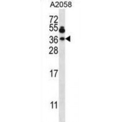 Vesicle-Associated Membrane Protein 7 (VAMP7) Antibody