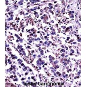 Calpain-11 (CAPN11) Antibody