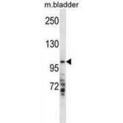 Transmembrane Serine Protease 7 (TMPRSS7) Antibody