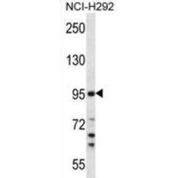 Transmembrane Serine Protease 7 (TMPRSS7) Antibody