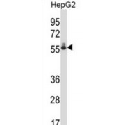 Differentially Expressed In FDCP 8 Homolog (DEF8) Antibody