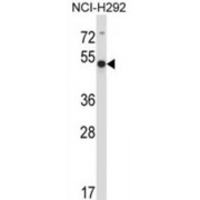 Actin-Related Protein 6 (ACTR6) Antibody