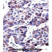 Dual Specificity Phosphatase 9 (DUSP9) Antibody