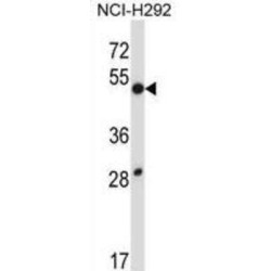 Dual Specificity Phosphatase 9 (DUSP9) Antibody