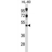 5-Hydroxytryptamine Receptor 2C (HTR2C) Antibody