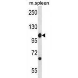 Tyrosine-Protein Kinase ABL1 (Abl1) Antibody