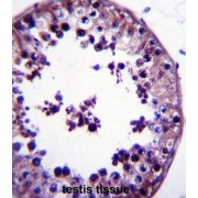 Translin-Associated Protein X (TSNAX) Antibody