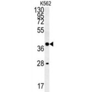 Protein Wnt-8b (WNT8B) Antibody