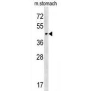 Carbohydrate Sulfotransferase 14 (CHST14) Antibody