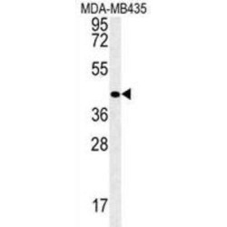 Vasohibin-2 (VASH2) Antibody