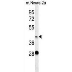 Vasohibin-2 (VASH2) Antibody