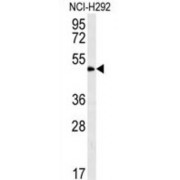 Zinc Finger Protein 154 (ZNF154) Antibody